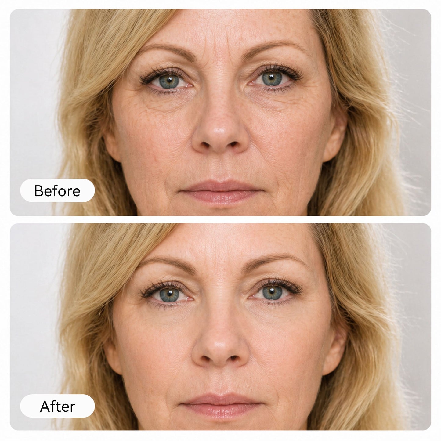 Sveltalab™ Korean NAD+ EGF Firming Serum